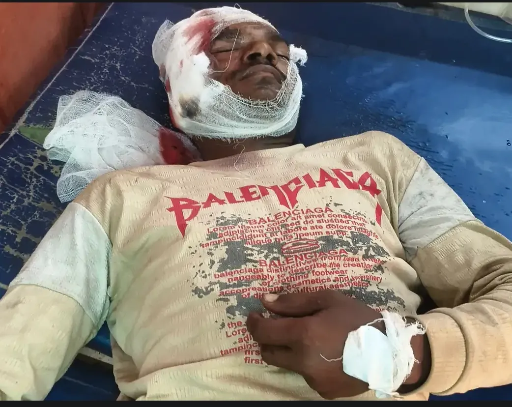 हरदोई मिक्सर मशीन पहुंचाने निकले दो मजदूरों को अज्ञात वाहन ने मारी टक्कर एक की मौत दूसरा लखनऊ रेफर