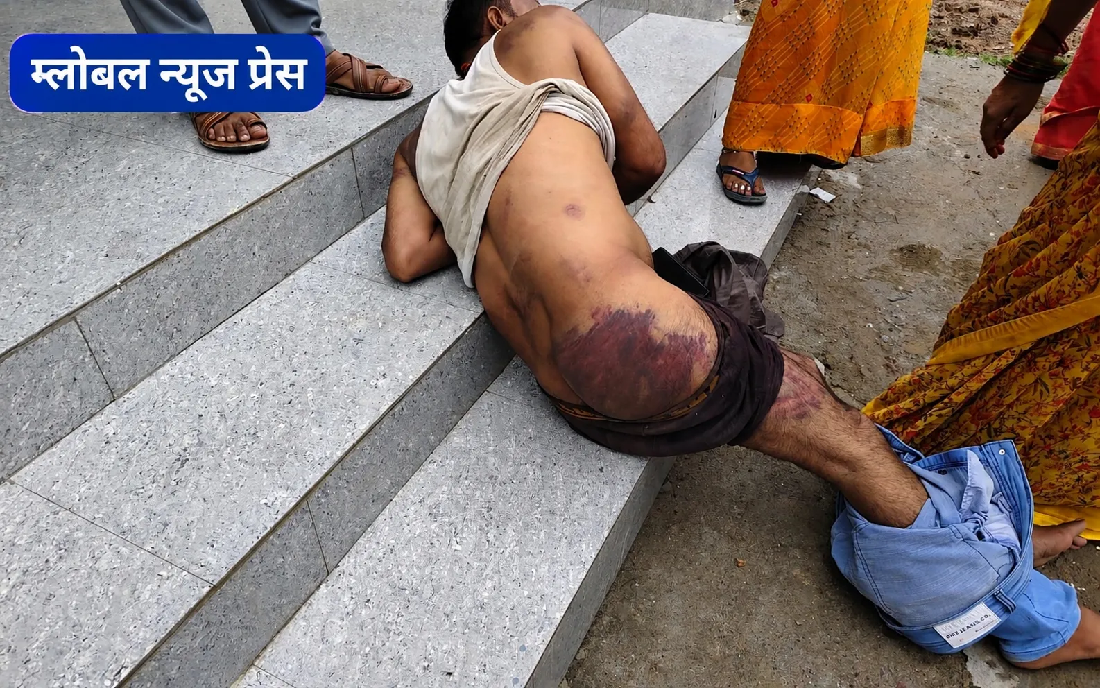 मछँड़ सेवा सहकारी संस्था के सहायक सचिव के साथ मारपीट में आधा दर्जन पर एफआईआर दर्ज*
🟰🟰🟰🟰🟰🟰🟰🟰🟰🟰
