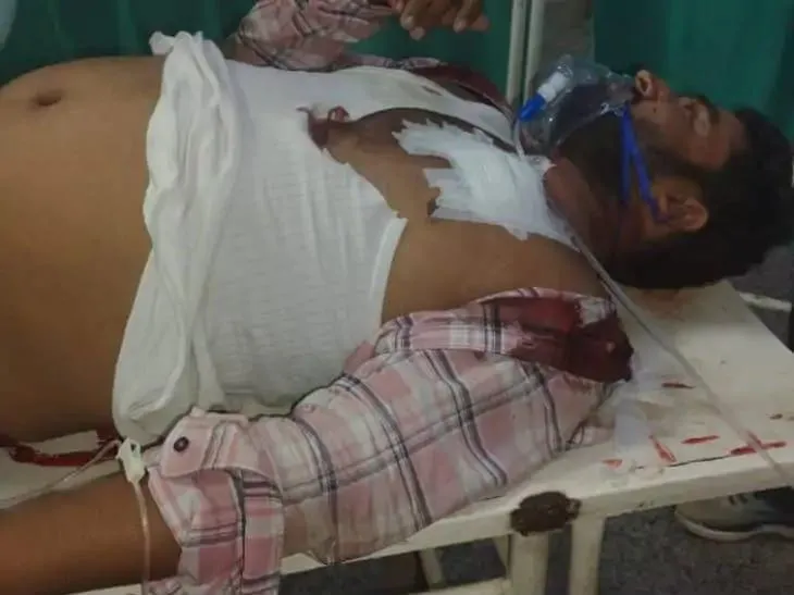 कंबल फैक्ट्री के चौकीदार के सीने में मारी गोली: गोरखपुर में बीआरडी में घायल भर्ती, लूट के लिए वारदात की आशंका