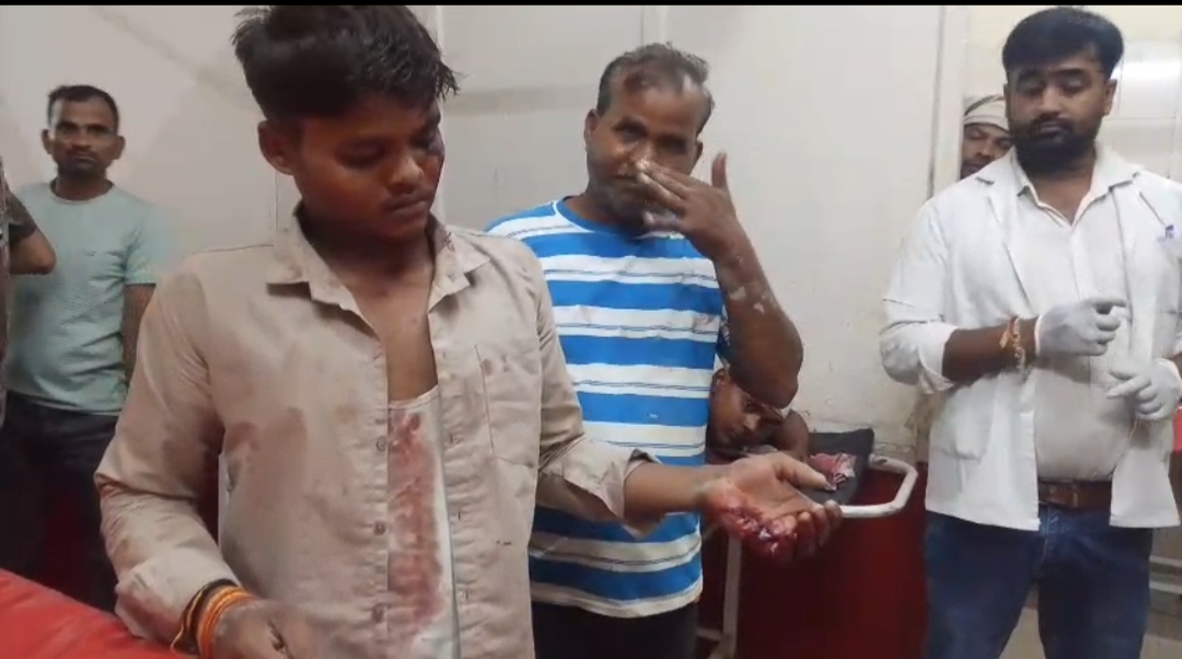 सल्फास की दवा मांगने पर विवाद, दो पक्षों में मारपीट उन्नाव। दही थाना क्षेत्र के कुईथर गांव में बीज भंडार की दुकान पर सल्फास की दवा मांगने को लेकर विवाद हो गया। देखते ही देखते दोनों पक्षों में मारपीट शुरू हो गई। एक पक्ष ने धारदार हथियार तो दूसरे ने सरिया से हमला करने का आरोप लगाया है। दोनों पक्षों के घायल जिला अस्पताल में भर्ती हैं। पुलिस शिकायत और मेडिकल रिपोर्ट के आधार पर मामले की जांच कर रही है।